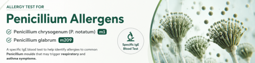 Specific IgE allergy blood test for Penicillium chrysogenum (P. notatum) m1 and Penicillium glabrum m209 mould allergens.